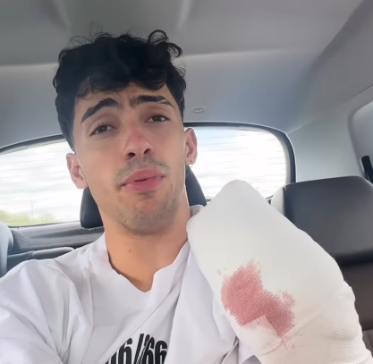 Gero Arias, el influencer que perdió dos dedos al hacer escalada