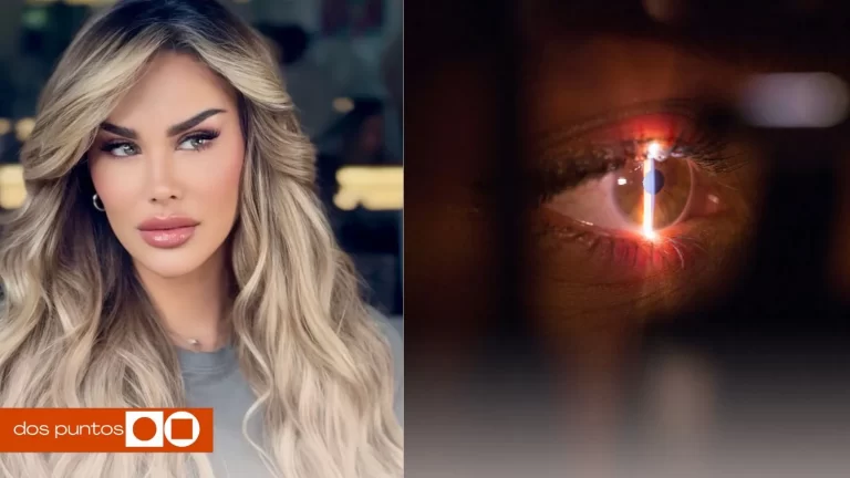 Ninel Conde, Ninel Conde Ojos verdes, Ninel conde operación, Queratopigmentación, Ninel conde operación ojos verdes, dos puntos, dos puntos media