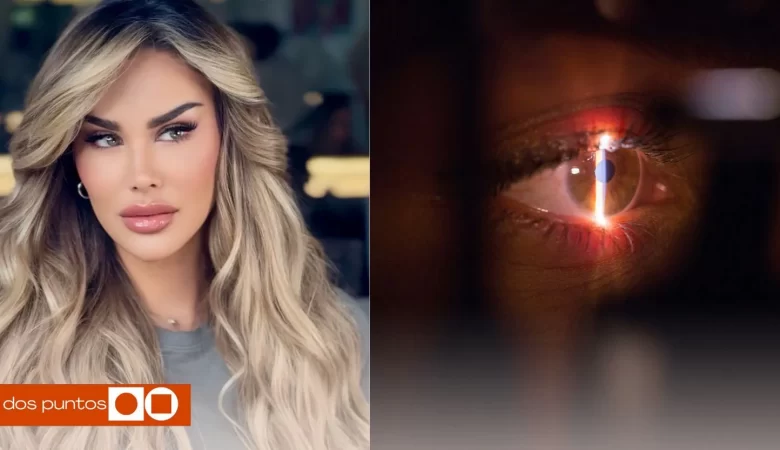 Ninel Conde, Ninel Conde Ojos verdes, Ninel conde operación, Queratopigmentación, Ninel conde operación ojos verdes, dos puntos, dos puntos media