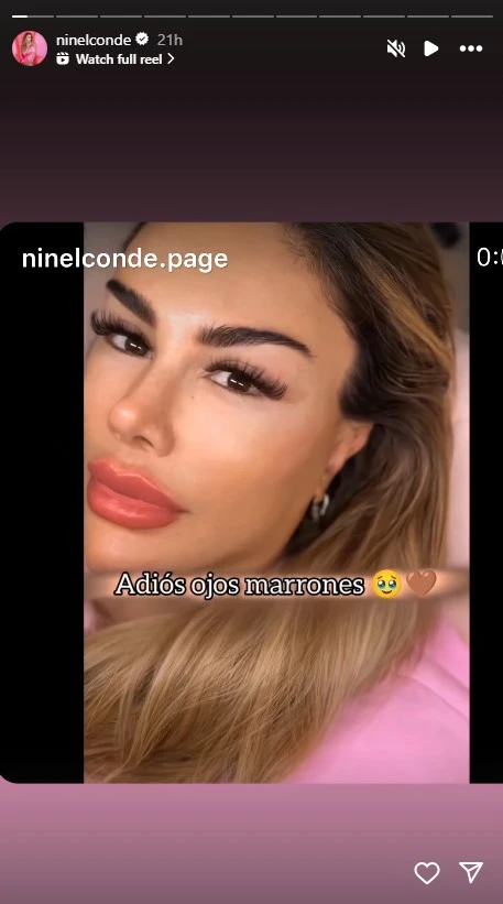 La temporada más reciente de La Casa de los Famosos fue bastante extraña. La cantante mexicana entró con las intenciones de ganar y en un principio parecía que ese sería el caso, pero en vez de eso se volvió de las primeras personas en irse. Esta experiencia le hizo ver que necesitaba un cambio y para reinventarse, Ninel Conde se hizo una operación llamada “queratopigmentación” para ponerse ojos verdes, un procedimiento de alto riesgo que le pudo costar la vista. En dos puntos te contamos todo lo que sabemos sobre esta tendencia de redes sociales: