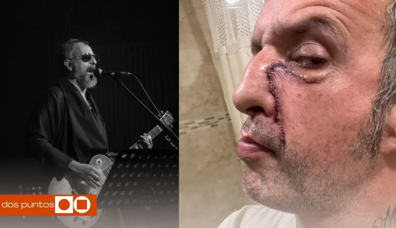 Tito Fuentes, Molotov, Quién es Tito Fuentes, Tito Fuentes Molotov, Cantante Molotov, dos puntos punto media