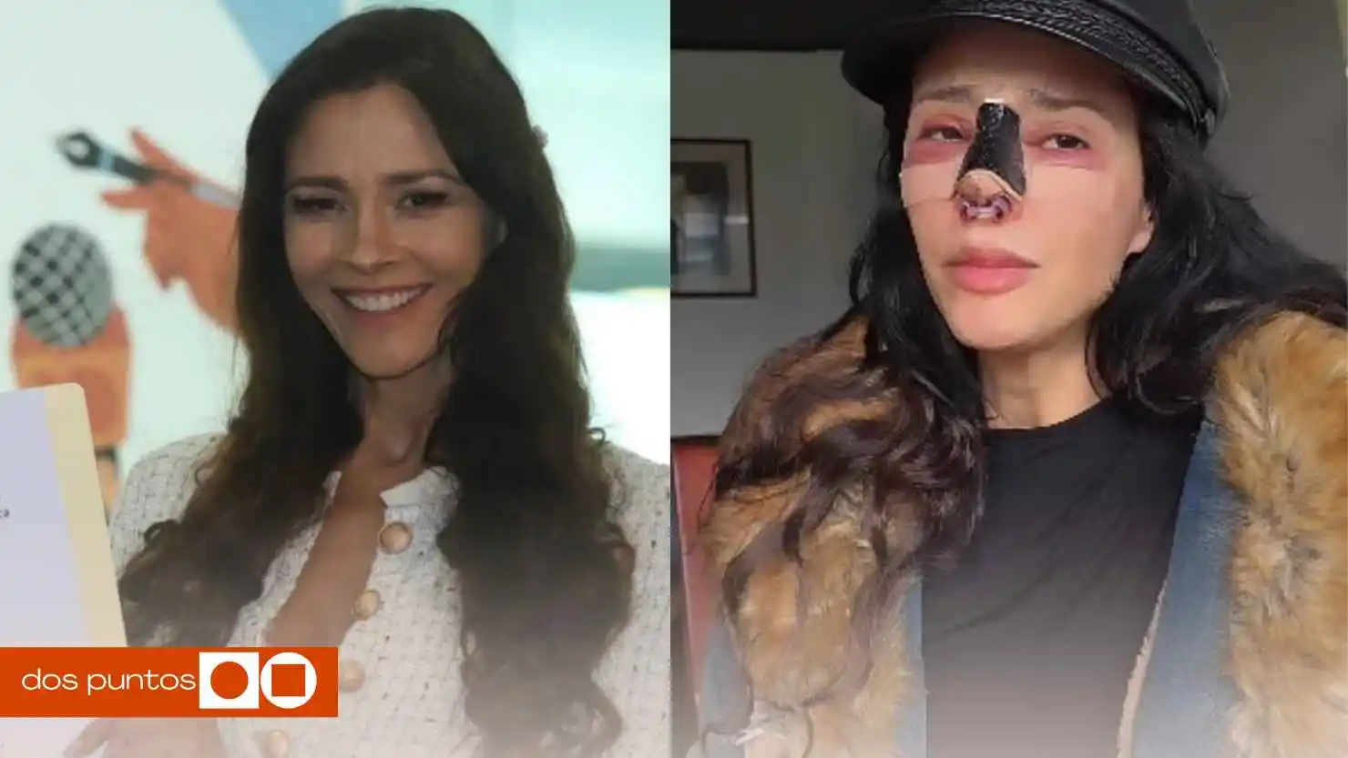 operación, Dorismar cirugía estética, Dorismar desfigurada, cambio físico Dorismar, cirugía Dorismar, polémica Dorismar, celebridades cirugía estética, Dorismar redes sociales