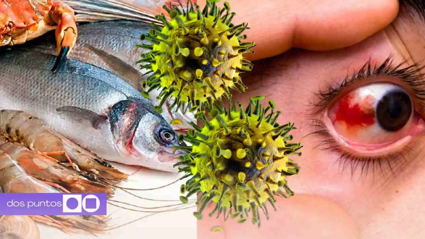 nodavirus CMNV, dos puntos punto media, virus ocular síntomas, nodavirus humanos, uveítis viral anterior, infección ocular virus marino, cómo se contagia nodavirus, prevención nodavirus, enfermedades zoonóticas ojos, virus que causa ceguera, salud visual infecciones, síntomas infección ocular grave, dos puntos punto media